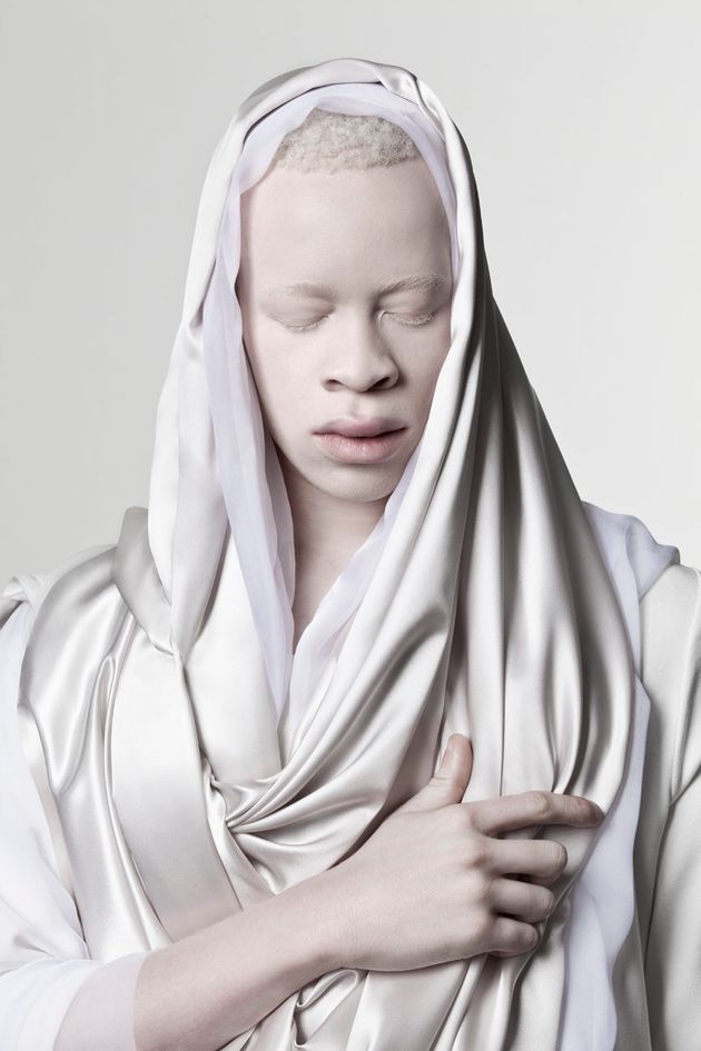 Stunning Photos Of Models With Albinism Capture The Beauty In Breaking Convention Huffpost