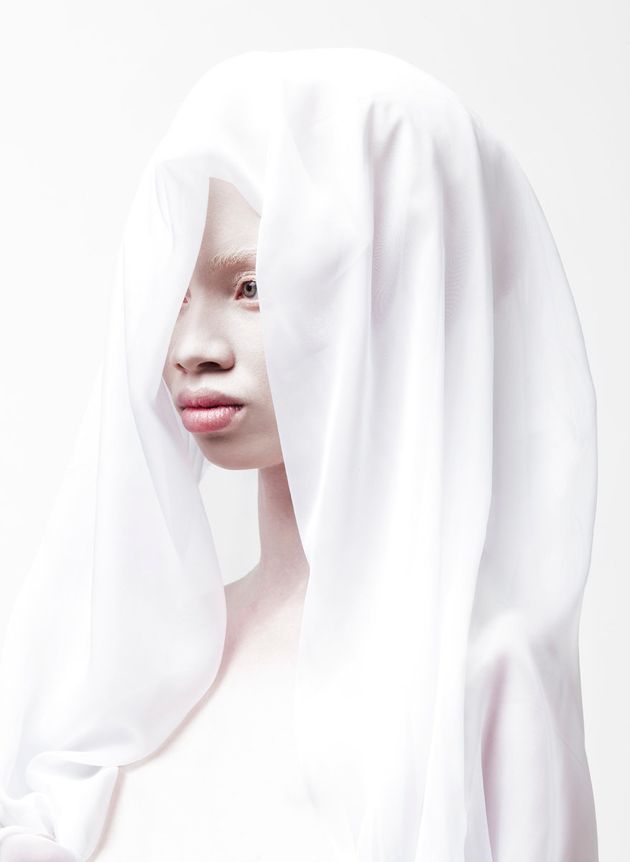 Stunning Photos Of Models With Albinism Capture The Beauty In Breaking Convention Huffpost