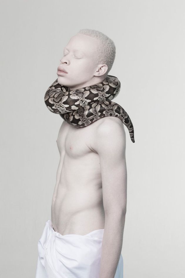 Stunning Photos Of Models With Albinism Capture The Beauty In Breaking Convention Huffpost