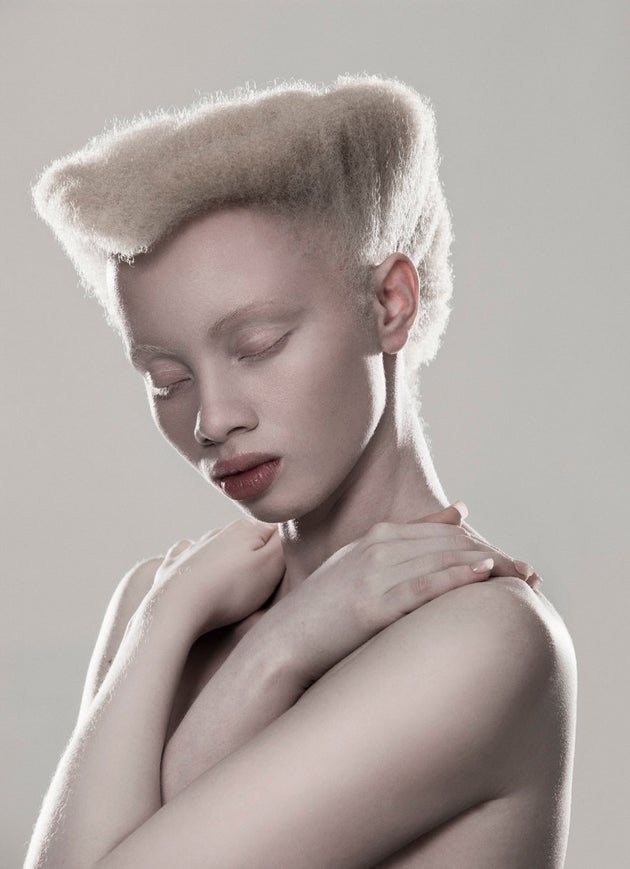 Stunning Photos Of Models With Albinism Capture The Beauty In Breaking Convention Huffpost