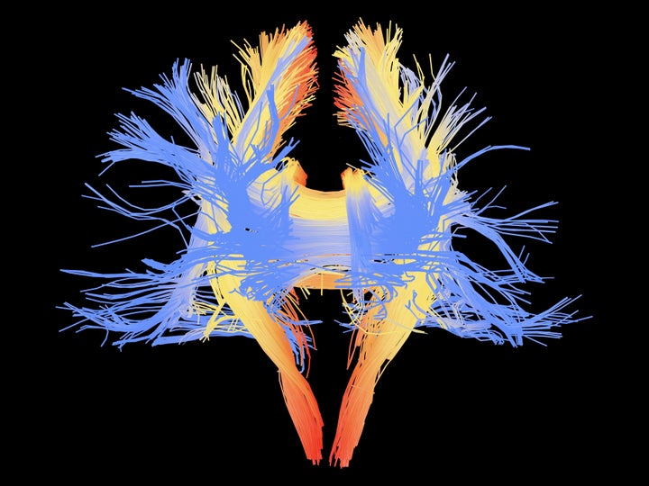 A colored 3D image shows neurons in the brain that could be important in social interactions, empathy and the evolution of language.