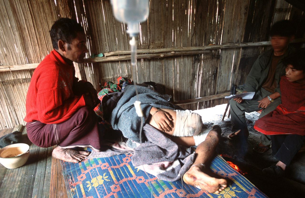 In this January 2004 photo, Cha Ka Luu Moo, a 17-year-old boy, is treated in a field hospital in Karen state after losing his leg in a landmine explosion. It's believed the mine was laid by the Myanmar army. 