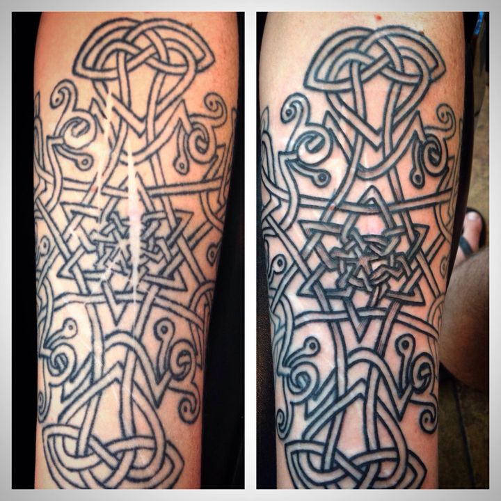 A Celtic knot, that Finn is reworking from an existing tattoo, over scars from self-harm. 