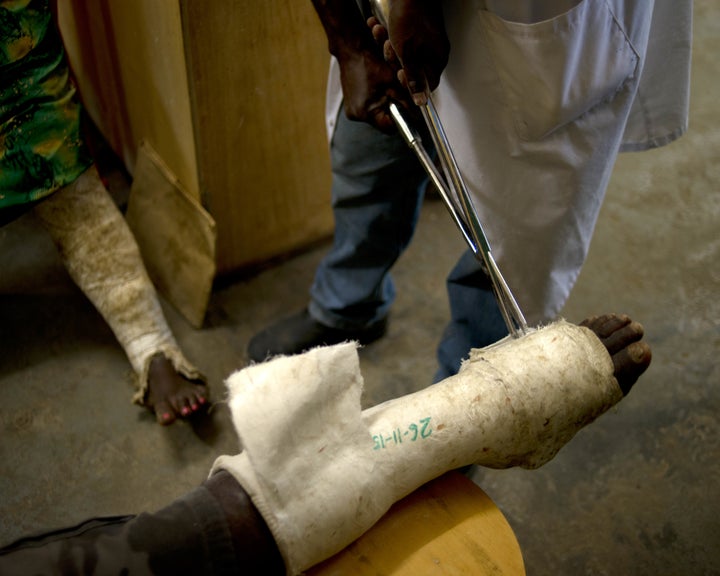 When MSF started running its surgical ward in Papua New Guinea, there were few programs that provided assistance to victims o