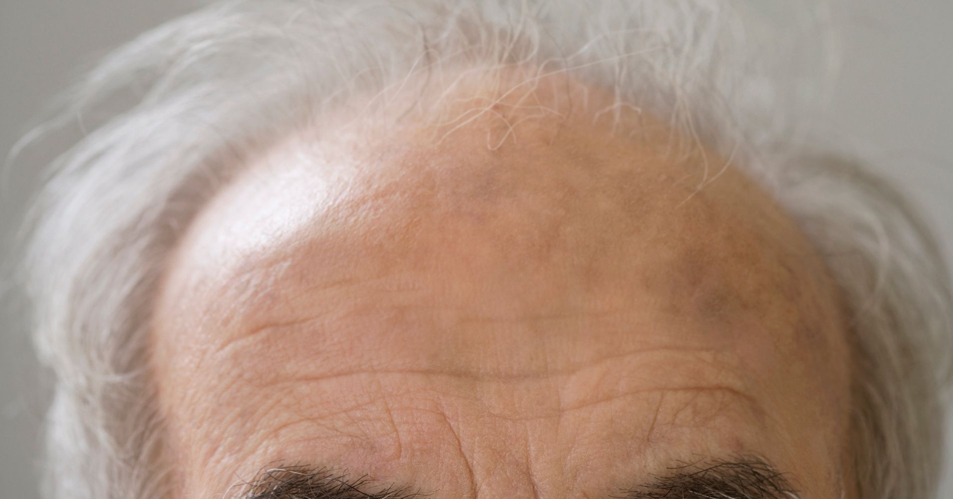 scientists-might-just-have-discovered-how-to-prevent-gray-hair-huffpost