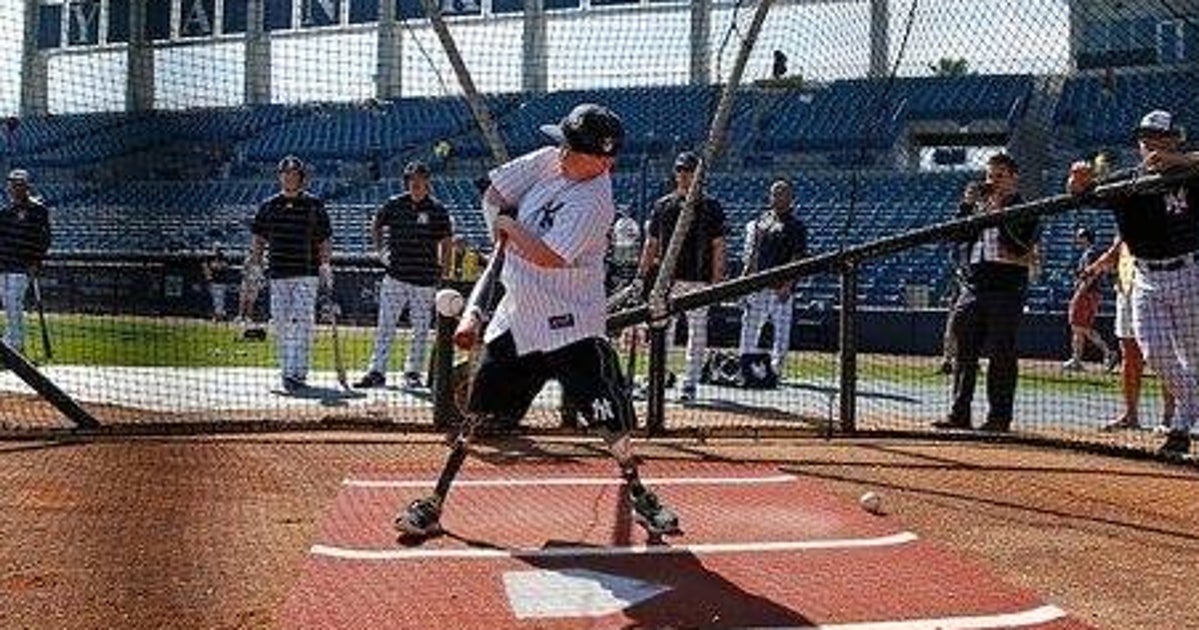 Yankees Sign Boy Born Without Hands And Lower Legs, Hit Grand Slam Into