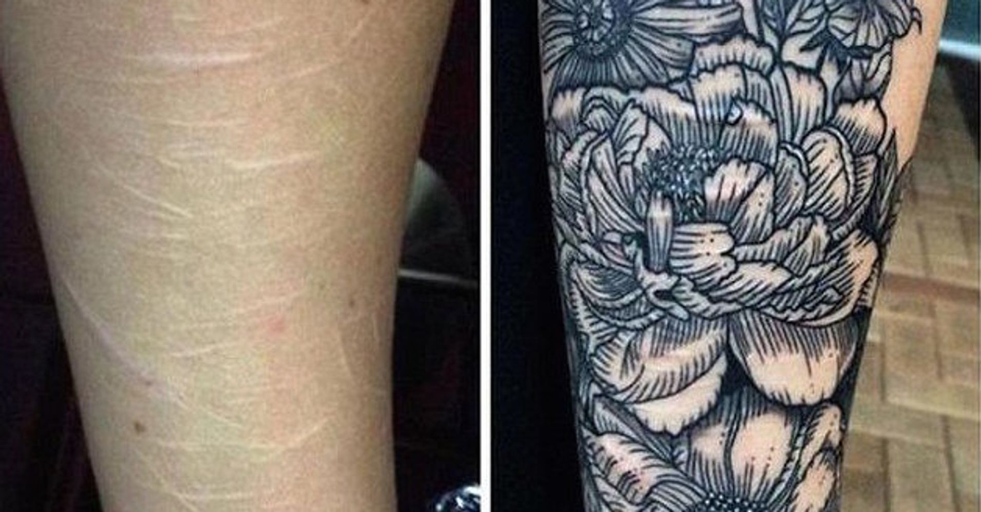 Tattoo Apprentice Turns Scars From SelfHarm Into Incredible Works Of