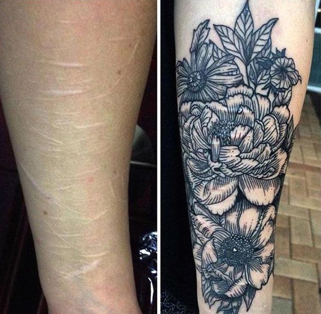 A before-and-after shot of a scar coverup Develle has done.