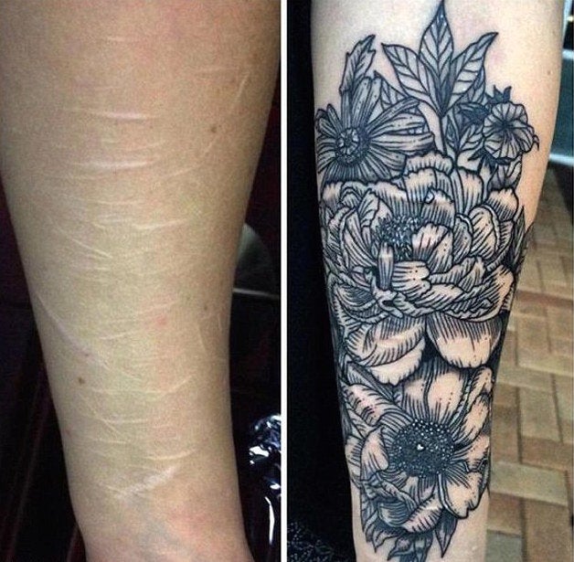 From Scar to Art: The Power of Tattoo Cover-Up