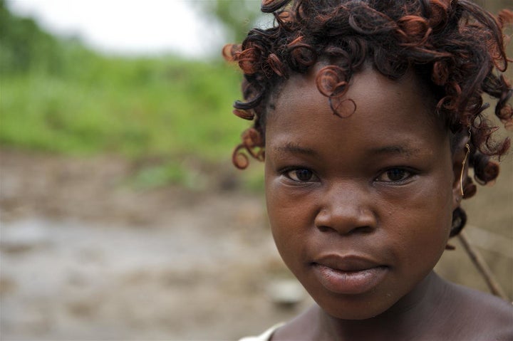Katushabe Choice, 20 years old, lives with her three children age 6, 3 and 1 respectively, in Western Uganda. She got married