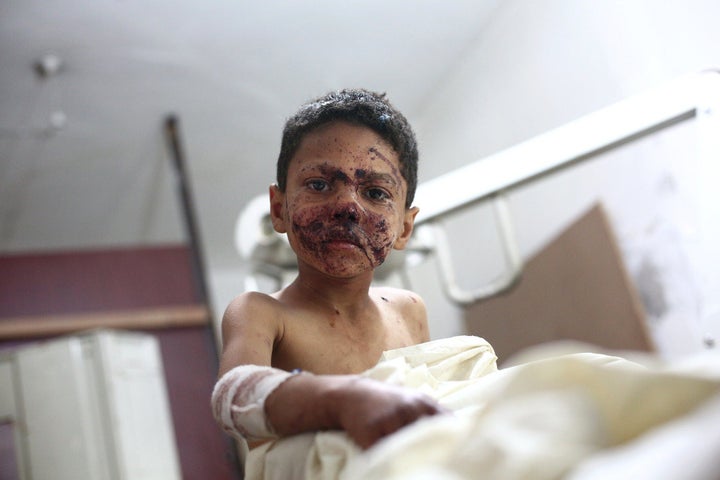 A wounded Syrian boy sits at a makeshift clinic after a mortar reportedly fired by Syrian government forces fell in the besie