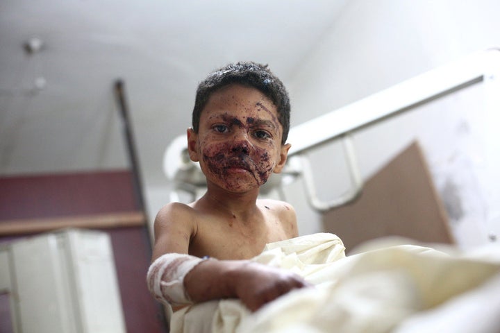 A wounded Syrian boy sits at a makeshift clinic after a mortar reportedly fired by Syrian government forces fell in the besieged rebel town of Douma.