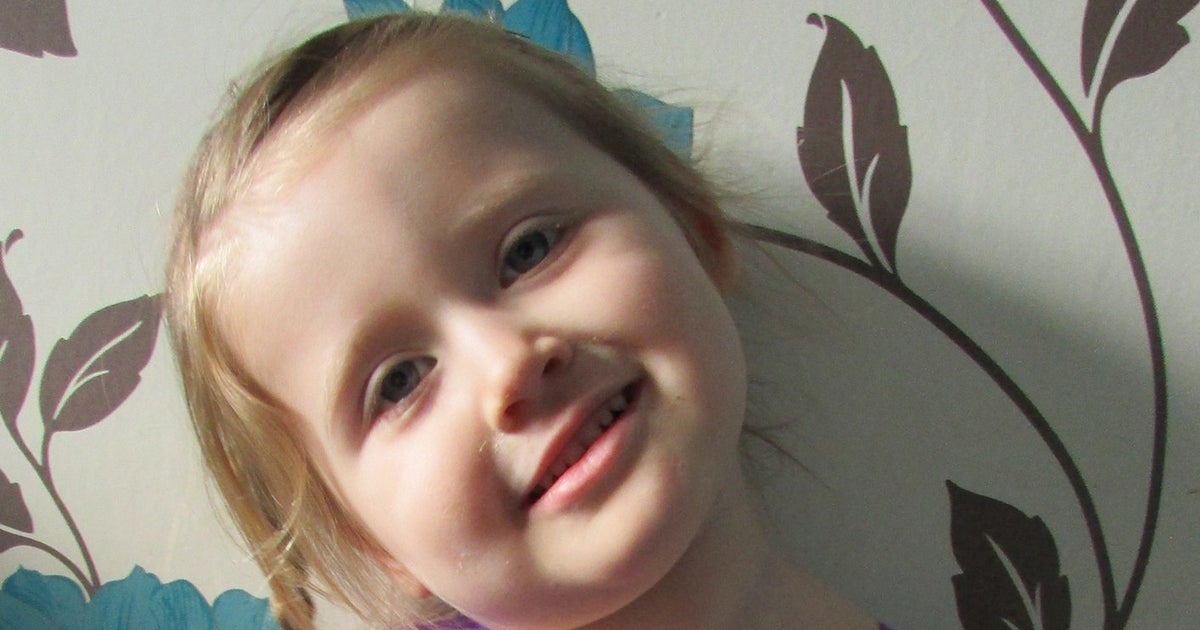 Mum Releases Shocking Image Of Daughter's Second-Degree Burns From ...