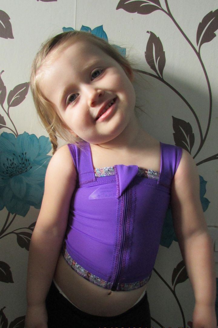 Bella Davey-Lawrence wearing her Frozen-inspired pressure garment.