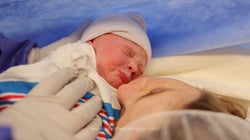 Touching Photographs Capture The Beauty Of Caesarean Births