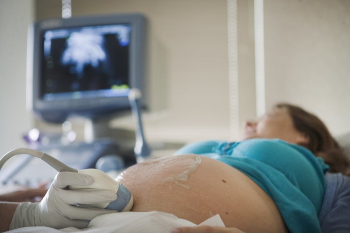 In some units, the percentage of mothers needing emergency c-sections nearly doubled.