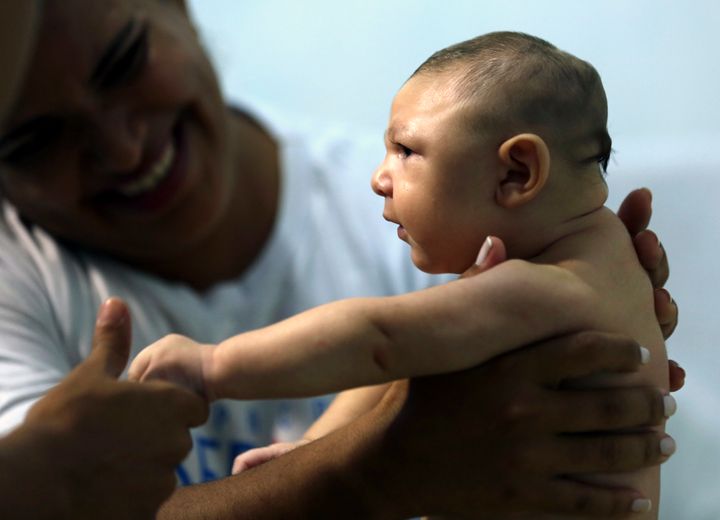 Scientists agree that Zika virus can cause the birth defect microcephaly, as well as the neurological disorder Guillain-Barre syndrome. 