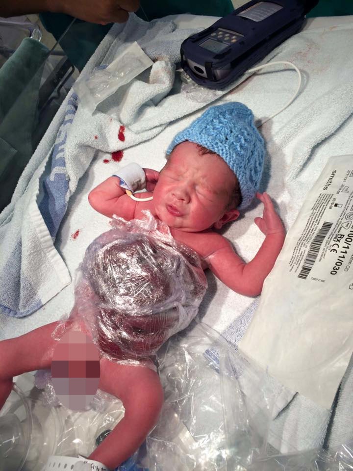 Miracle' Boy Born With Bowel Outside Body: 'It's Amazing He Pulled Through' | HuffPost UK Parents