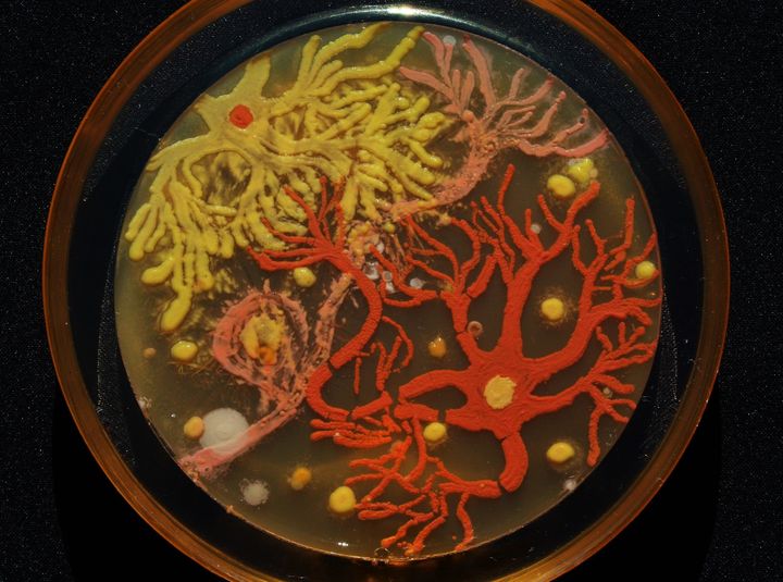 Peñil's "Neurons," which won first place in the 2015 ASM Agar Art contest.