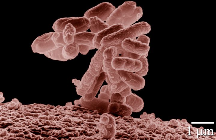 An electron micrograph image of a cluster of E. coli bacteria.