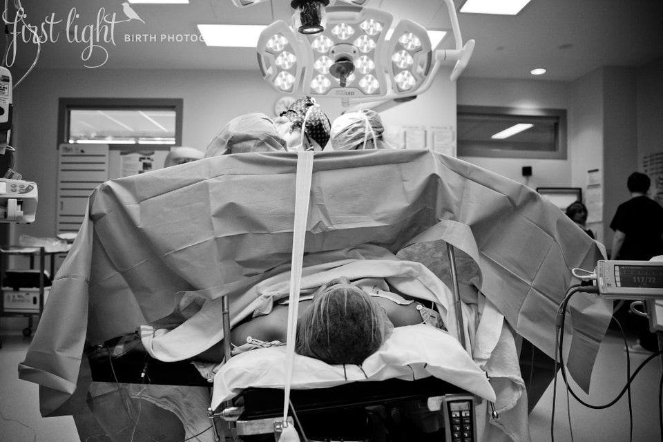 15 Intimate Birth Photos That Show How Beautiful C-Sections Can Be ...