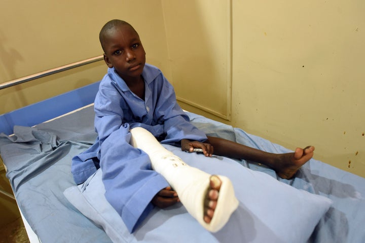 This Nigerian boy in Maiduguri is one of many injured in Boko Haram attacks. At least 17,000 people are estimated to have been killed since the militants began their deadly insurgency nearly seven years ago. 