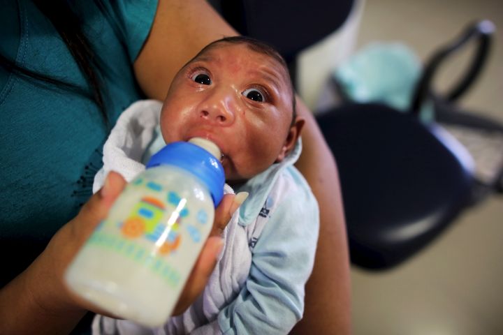 The U.S. Centers for Disease Control and Prevention said it agrees with international consensus that the Zika virus causes microcephaly and other fetal birth defects.