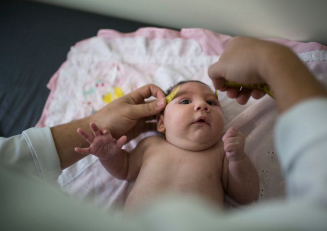 In this Dec. 22, 2015, photo, Luiza has her head measured by a neurologist at the Mestre Vitalino Hospital in Caruaru, Pernambuco state, Brazil. Luiza was born in October with a head that was just 11.4 inches (29 centimeters) in diameter, more than an inch (3 centimeters) below the range defined as healthy by doctors.