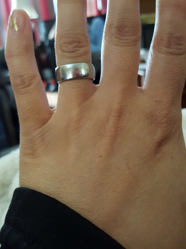 Husband Broke His Ring Finger Husband Broke His Ring Finger