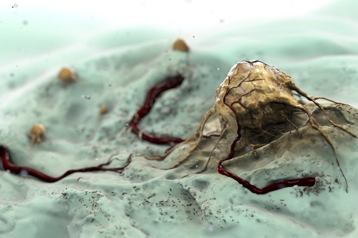 A single cancer cell
