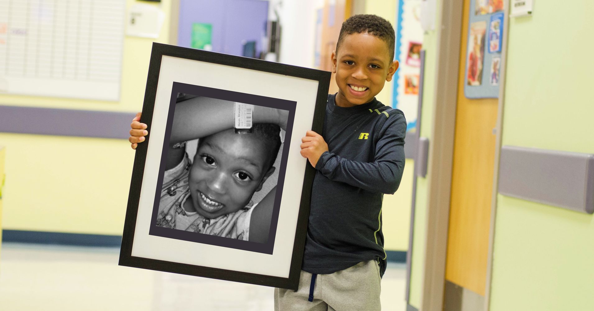 Before-And-After Photos Of Kids Show Why Organ Donation Is So Important ...