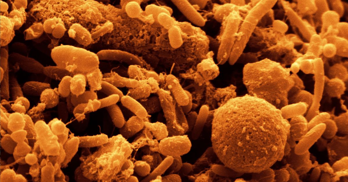 Бактерии домашних условиях. Микробиота бактерии грибки. Бактерии под микроскопом. Микроорганизмы под микроскопом. Микробы в микроскопе.