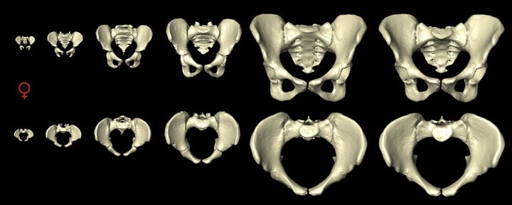 A computer model shows views of the female pelvis from the front (top row) and from above (bottom row) as it change