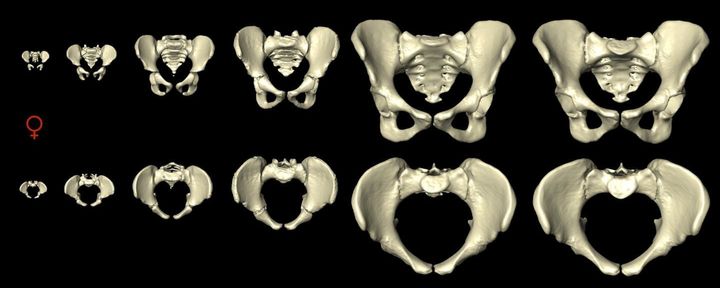 A computer model shows views of the female pelvis from the front (top row) and from above (bottom row) as it changes during a woman's lifetime.