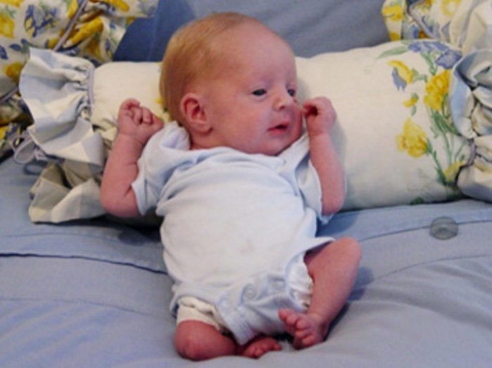 Cody was born with a rare birth defect called Sacral Agenesis. Both of his legs formed without tibias and knees.