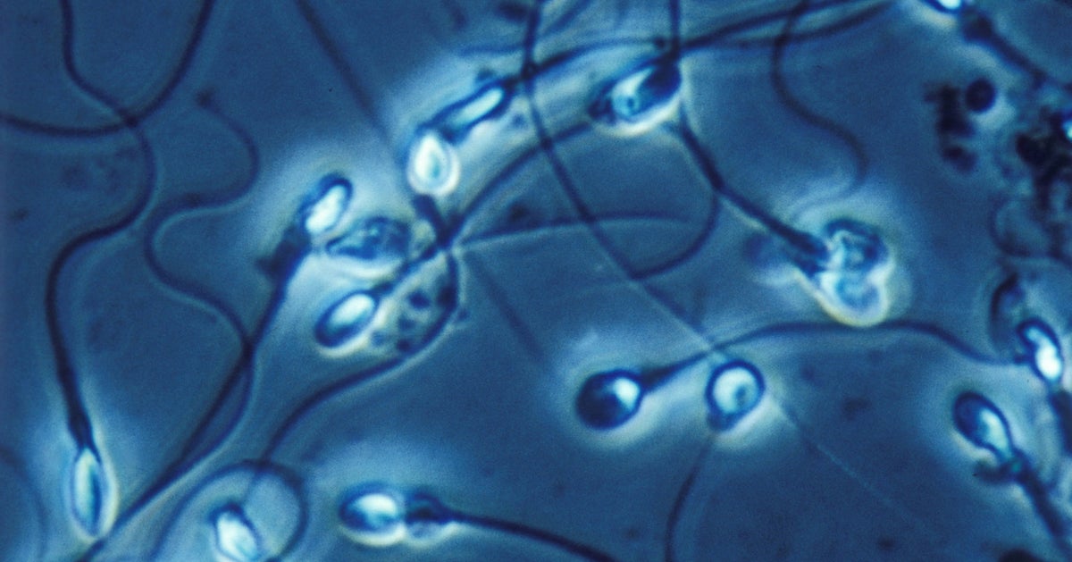 These Lifestyle Factors Are Linked To Sperm Damage HuffPost Life