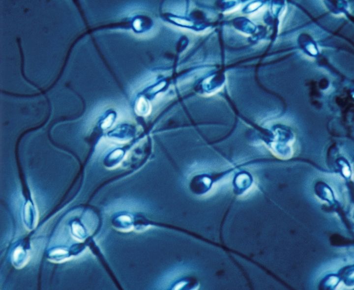 Sperm DNA damage can affect male fertility as well as the genes they pass on to their kids. 