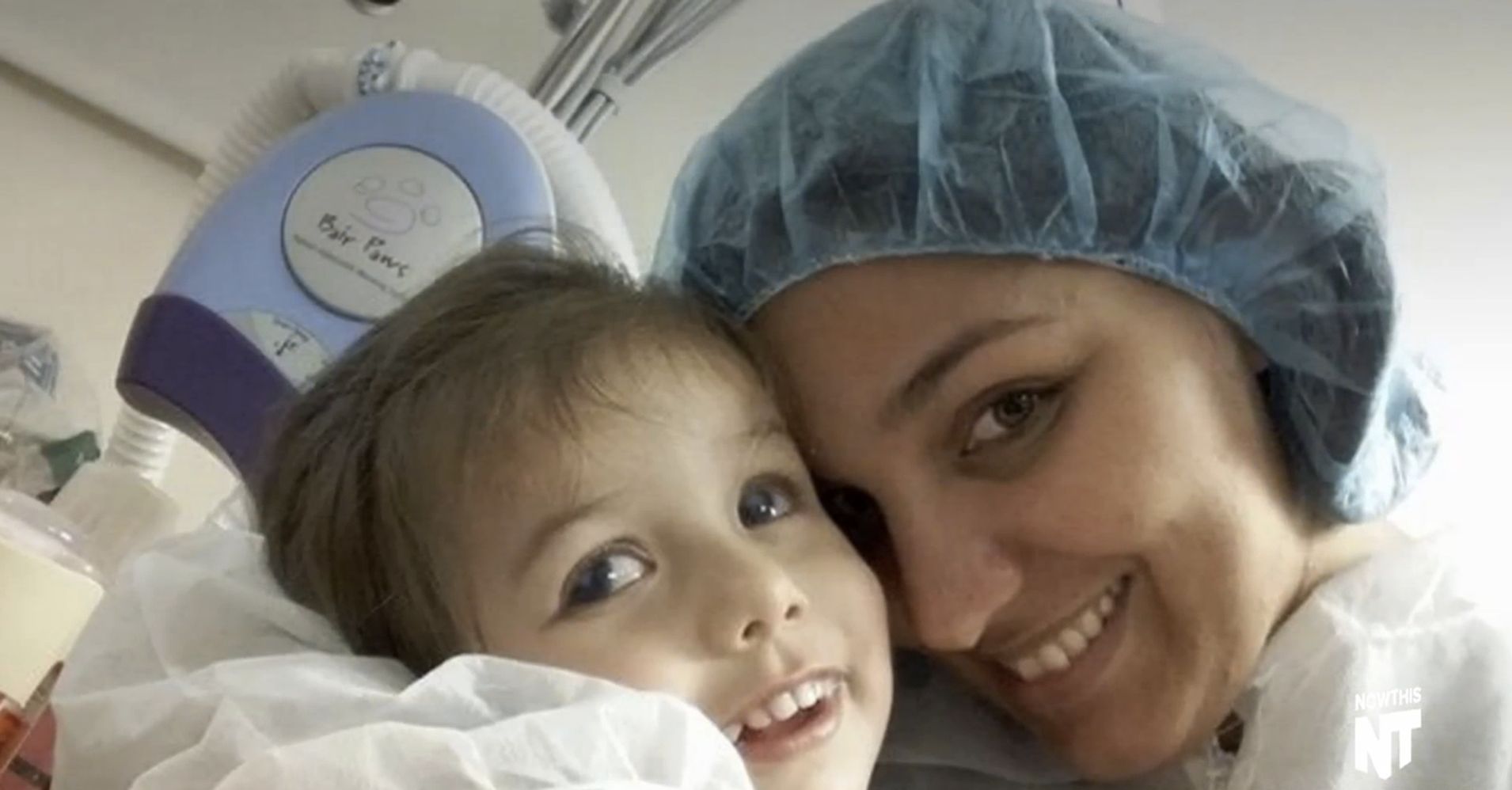 After Transformative Surgery 2 Year Old Sees Mother For The First Time 