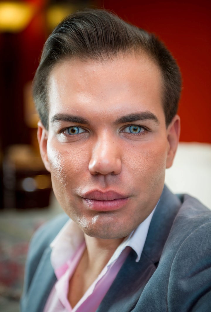 Rodrigo Alves has had 42 operations to alter his appearance 