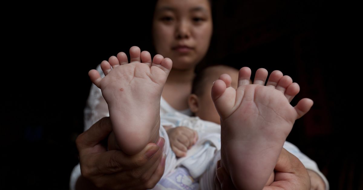 Рука нога когда у ребенка. Синдактилия полидактилия. Полидактилия генная мутация. Полидактилия наследственность.
