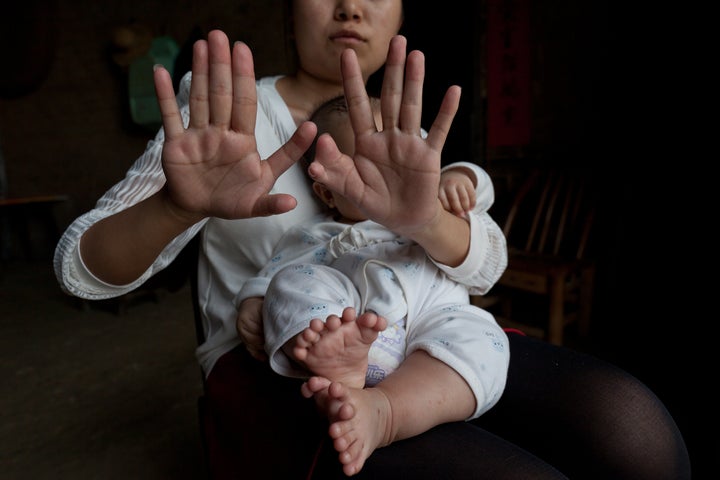 Hong Hong's mother has six fingers on each hand, and six toes on each foot.