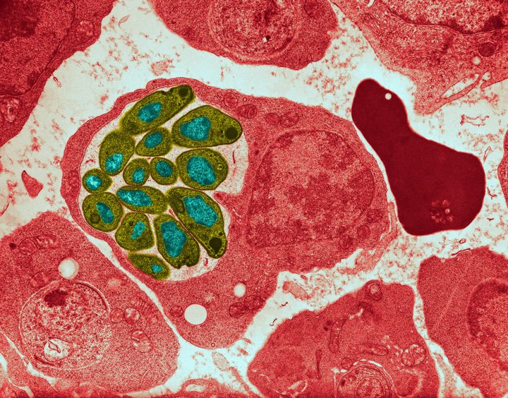 Color enhanced Transmission Electron Micrograph (TEM) showing malaria (Plasmodium cathemerium) infecting blood. Magnification unknown.