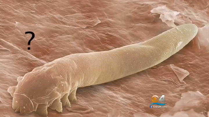 Demodex