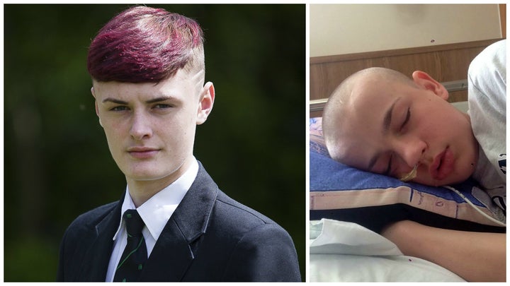 Daniel Bradbury, left, was placed in isolation for dying his hair to support his friend Kallum Aish, right