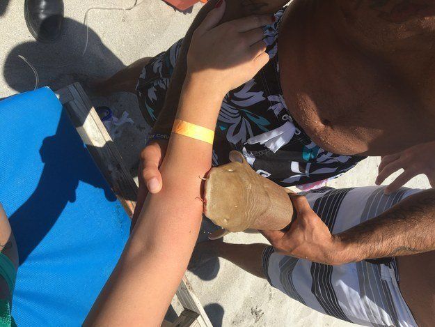 A nurse shark is seen clamping onto a woman's arm after biting her in the waters off Boca Raton, Florida on Sunday.