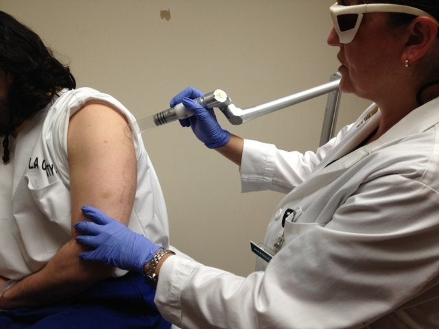 An inmate, getting some ink removed. 