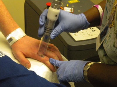 An inmate, undergoing the tattoo removal procedure. 