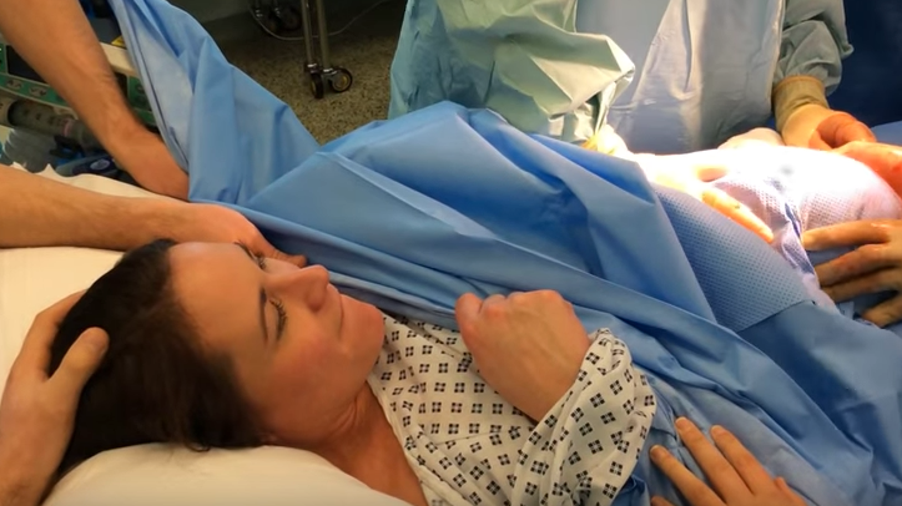 Fascinating Video Shows Mum Having 'Natural Caesarean' Where Baby