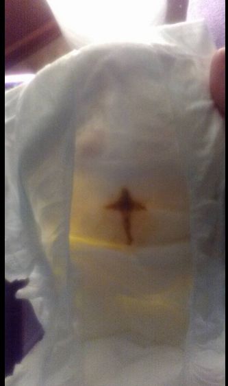 Katy Vasquez was changing her son's diaper when she noticed this cross-shaped stain.