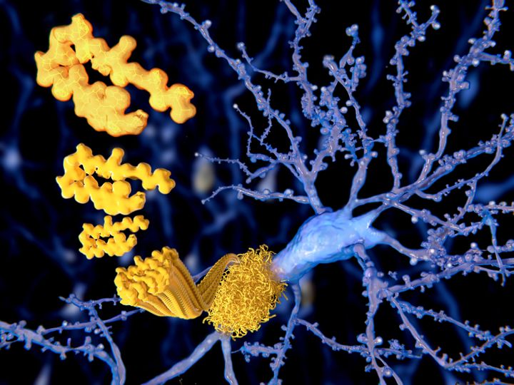 Amyloid plaques, that may damage and kill neurons by generating reactive oxygen species during its self-aggregation.